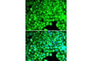 Immunofluorescence analysis of U2OS cells using CYTH2 antibody (ABIN5974231). (Cytohesin 2 Antikörper)