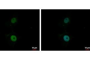 Immunofluorescence (IF) image for anti-B-Cell CLL/lymphoma 7A (BCL7A) (C-Term) antibody (ABIN2854648)