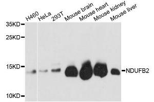 NDUFB2 Antikörper  (AA 34-105)