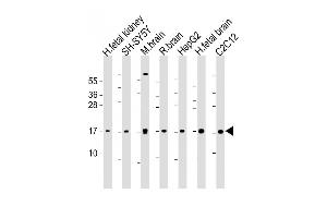 All lanes : Anti-Autophagy GABAR Antibody (N-term) at 1:1000-1 :2000 dilution Lane 1: human fetal kidney lysate Lane 2: SH-SY5Y whole cell lysate Lane 3: mouse brain lysate Lane 4: rat brain whole cell lysate Lane 5: HepG2 whole cell lysate Lane 6: human fetal brain lysate Lane 7: C2C12 whole cell lysate Lysates/proteins at 20 μg per lane. (GABARAP Antikörper  (AA 1-30))
