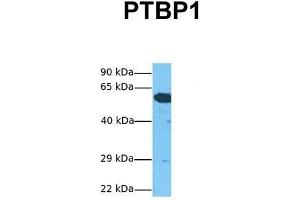 Host:  Rabbit  Target Name:  PTBP1  Sample Tissue:  Human HepG2  Antibody Dilution:  1. (PTBP1 Antikörper  (N-Term))