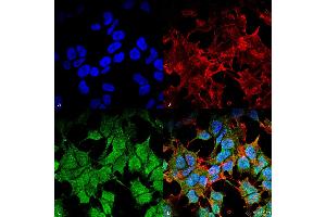 Immunocytochemistry/Immunofluorescence analysis using Mouse Anti-Kir6.