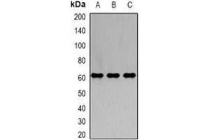 Western blot analysis of IRSp53 expression in A549 (A), K562 (B), SW620 (C) whole cell lysates. (BAIAP2 Antikörper)