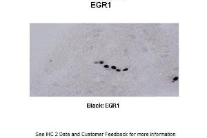 Sample Type : Frog brain Primary Antibody Dilution : 1:500 Secondary Antibody : Biotinylated goat anti-rabbit Secondary Antibody Dilution : 1:200 Color/Signal Descriptions : Black: EGR1 Gene Name : Egr1 a Submitted by : Eva Fischer, Colorado State University (EGR1 Antikörper  (C-Term))
