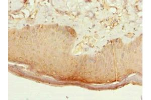 Immunohistochemistry of paraffin-embedded human skin tissue using ABIN7146656 at dilution of 1:100 (CMTR2 Antikörper  (AA 301-600))