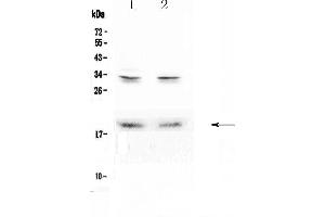 Western blot analysis of Pleiotrophin using anti-Pleiotrophin antibody . (Pleiotrophin Antikörper  (AA 33-168))