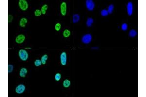 Immunofluorescence of Rabbit Anti-Histone H3 K4/me3 Antibody. (Histone 3 Antikörper  (H3K4me3))