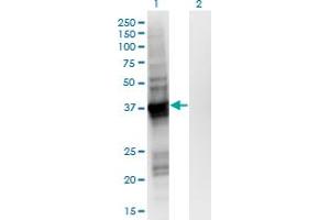 Western Blot analysis of GIPC2 expression in transfected 293T cell line by GIPC2 monoclonal antibody (M02), clone 4H8. (GIPC2 Antikörper  (AA 1-315))