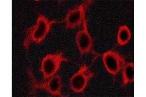 Immunofluorescence (fixed cells) (IF/ICC) image for anti-Tyrosine Hydroxylase (TH) (pSer19) antibody (ABIN6255056)