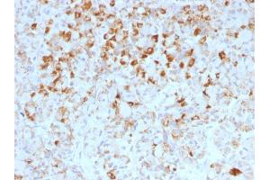 Formalin-fixed, paraffin-embedded human Pituitary stained with LH-beta Mouse Monoclonal Antibody (LHb/1214). (LHB Antikörper)