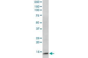 CIDEC monoclonal antibody (M07), clone 2E2. (CIDEC Antikörper  (AA 53-141))