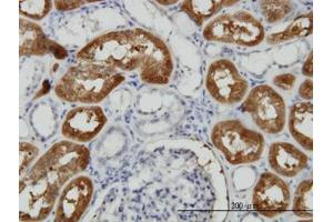 Image no. 4 for anti-Formiminotransferase Cyclodeaminase (FTCD) (AA 440-542) antibody (ABIN599156) (FTCD Antikörper  (AA 440-542))