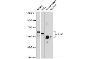 Western blot analysis of extracts of various cell lines using A1BG Polyclonal Antibody at dilution of 1:3000. (A1BG Antikörper)