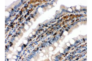 Anti- Cofilin Picoband antibody, IHC(P) IHC(P): Rat Intestine Tissue (Cofilin Antikörper  (C-Term))