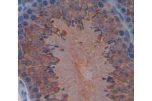IHC-P analysis of Mouse Tissue, with DAB staining. (Hexokinase 1 Antikörper  (AA 137-270))
