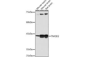 Western blot analysis of extracts of various cell lines, using TMOD2 Rabbit mAb (ABIN7271011) at 1:1000 dilution. (TMOD2 Antikörper)