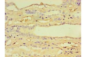 Immunohistochemistry of paraffin-embedded human kidney tissue using ABIN7157760 at dilution of 1:100 (CCBL1 Antikörper  (AA 1-372))