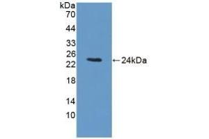 Detection of Recombinant BCKDK, Rat using Polyclonal Antibody to Branched Chain Alpha-Ketoacid Dehydrogenase Kinase (BCKDK) (BCKDK Antikörper  (AA 44-223))