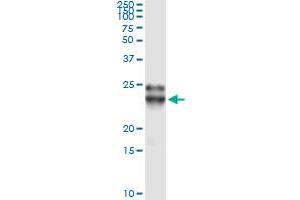Immunoprecipitation of FGF21 transfected lysate using anti-FGF21 monoclonal antibody and Protein A Magnetic Bead , and immunoblotted with FGF21 MaxPab rabbit polyclonal antibody. (FGF21 Antikörper  (AA 30-209))