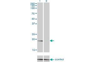 Western blot analysis of NME1 over-expressed 293 cell line, cotransfected with NME1 Validated Chimera RNAi (Lane 2) or non-transfected control (Lane 1). (NME1 Antikörper  (AA 1-152))