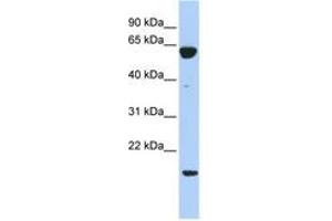 Image no. 1 for anti-Protein Tyrosine Phosphatase Type IVA, Member 3 (PTP4A3) (C-Term) antibody (ABIN6743577) (PTP4A3 Antikörper  (C-Term))