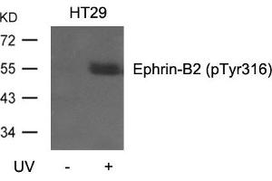 Western blot analysis of extracts from HT29 cells, untreated or treated with UV using Ephrin-B2(Phospho-Tyr316) Antibody. (Ephrin B2 Antikörper  (pTyr316))