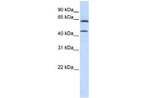 WB Suggested Anti-ChGn Antibody Titration:  0. (CSGALNACT1 Antikörper  (C-Term))