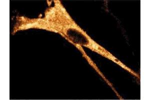Immunofluorescence staining of WI-38 cells (Human lung fibroblasts, ATCC CCL-75). (RIPK1 Antikörper  (AA 385-650))