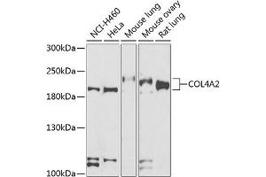 Western blot analysis of extracts of various cell lines, using COL4 antibody (ABIN6134493, ABIN6138843, ABIN6138844 and ABIN6223578) at 1:500 dilution. (COL4a2 Antikörper  (AA 1486-1712))