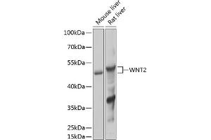 Western blot analysis of extracts of various cell lines, using WNT2 Antibody (ABIN6134457, ABIN6150238, ABIN6150240 and ABIN6217609) at 1:1000 dilution.