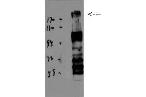 Western Blot (WB) analysis of JK using BRCA1 Polyclonal Antibody diluted at 1:1000. (BRCA1 Antikörper  (Ser184, Ser186))