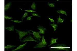 Immunofluorescence of monoclonal antibody to SEC63 on HeLa cell. (SEC63 Antikörper  (AA 631-728))