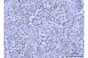 IHC analysis of Hamartin/TSC1 using anti-Hamartin/TSC1 antibody (ABIN7599499). (TSC1 Antikörper  (AA 1-618))