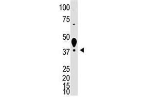 Image no. 1 for anti-Lymphatic Vessel Endothelial Hyaluronan Receptor 1 (LYVE1) (N-Term) antibody (ABIN357391)