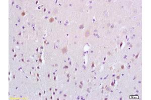 Formalin-fixed and paraffin embedded rat brain tissue labeled with Anti-ERK4 Polyclonal Antibody, Unconjugated (ABIN754288) at 1:200 followed by conjugation to the secondary antibody and DAB staining (MAPK7 Antikörper  (AA 401-500))