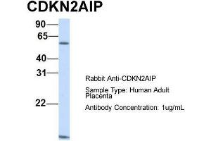Host:  Rabbit  Target Name:  CDKN2AIP  Sample Type:  Human Adult Placenta  Antibody Dilution:  1. (CDKN2AIP Antikörper  (N-Term))