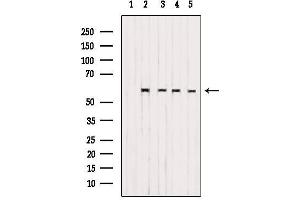 Western blot analysis of extracts from various samples, using CS061 Antibody. (SMG9 Antikörper  (Internal Region))