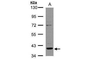 WB Image Sample(30 ug whole cell lysate) A:Raji , 10% SDS PAGE antibody diluted at 1:2000 (RAD51 Homolog B Antikörper  (Center))