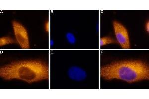 Expression of Adenosine A3 Receptor in a human melanoma cell line - Immunocytochemical staining of paraformaldehyde-fixed and permeabilized  human melanoma cells (A2058). (Adenosine A3 Receptor Antikörper  (3rd Intracellular Loop))