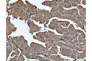IHC analysis of VPS53 using anti-VPS53 antibody (ABIN7599731). (VPS53 Antikörper  (AA 11-699))