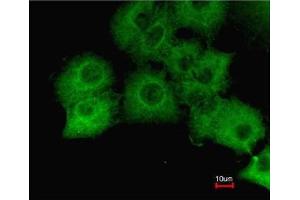 Immunofluorescence analysis of paraformaldehyde-fixed A549, using GAPDH antibody at 1:200 dilution. (GAPDH Antikörper  (AA 9-323))