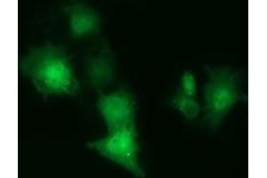 Anti-CBWD1 mouse monoclonal antibody (ABIN2452882) immunofluorescent staining of COS7 cells transiently transfected by pCMV6-ENTRY CBWD1 (RC222790). (CBWD1 Antikörper)