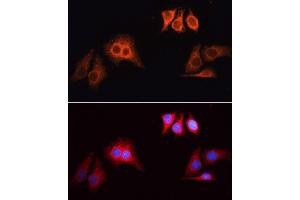 Immunofluorescence analysis of HeLa cells, using  antibody (ABIN1678537, ABIN3017991, ABIN3017992 and ABIN6220329) as the primary antibody at dilution of 1:100. (Ziege anti-Kaninchen IgG Antikörper (Rhodamine))