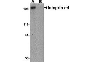 Western blot analysis of Integrin alpha 4 in Jurkat cell lysate with AP30434PU-N Integrin alpha 4 antibody at 1 μg/ml in (A) the absence and (B) the presence of blocking peptide. (ITGA4 Antikörper  (C-Term))