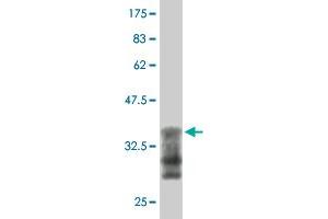 Western Blotting (WB) image for anti-Nuclear Receptor Subfamily 3, Group C, Member 2 (NR3C2) (AA 1-110) antibody (ABIN561832)