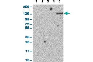 Western Blot analysis with ENPP1 polyclonal antibody . (ENPP1 Antikörper  (AA 96-149))