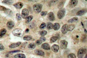 Image no. 1 for anti-Cell Division Cycle 25 Homolog C (S. Pombe) (CDC25C) antibody (ABIN265342) (CDC25C Antikörper)