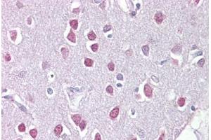 Anti-ETV1 / ER81 antibody IHC staining of human brain, cerebellum. (ETV1 Antikörper  (C-Term))