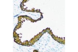 Immunohistochemical analysis of RRM1 staining in human prostate formalin fixed paraffin embedded tissue section. (RRM1 Antikörper)