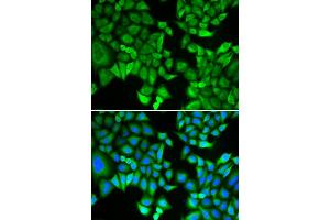 Immunofluorescence analysis of A549 cell using KPNA2 antibody. (KPNA2 Antikörper)